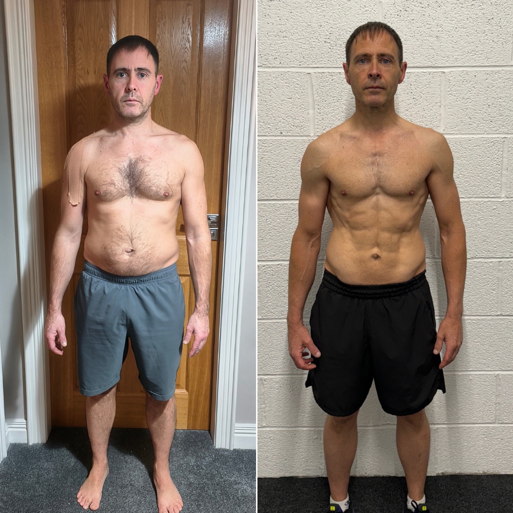 Chrissy, before and after